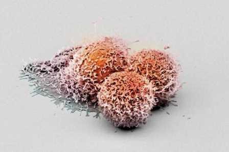 Раковые клетки выключают «контроль качества» при синтезе ДНК