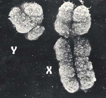 Короткую жизнь мужчин связали с “токсическим» действием Y-хромосомы